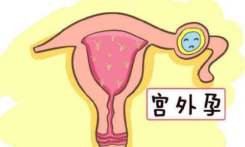 Ԥע