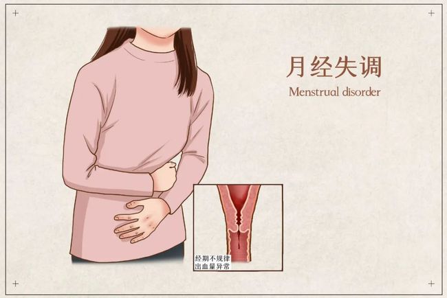Ԥ֢״ϵ