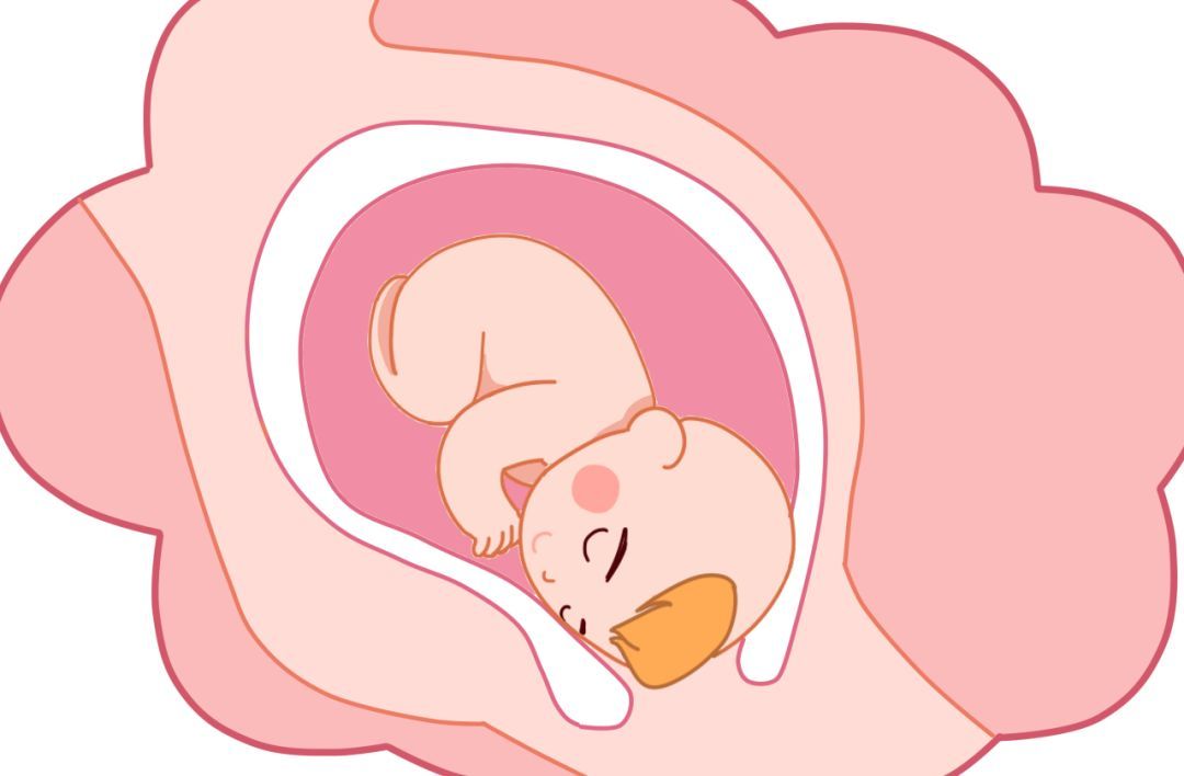 宫外孕症状诊断治疗